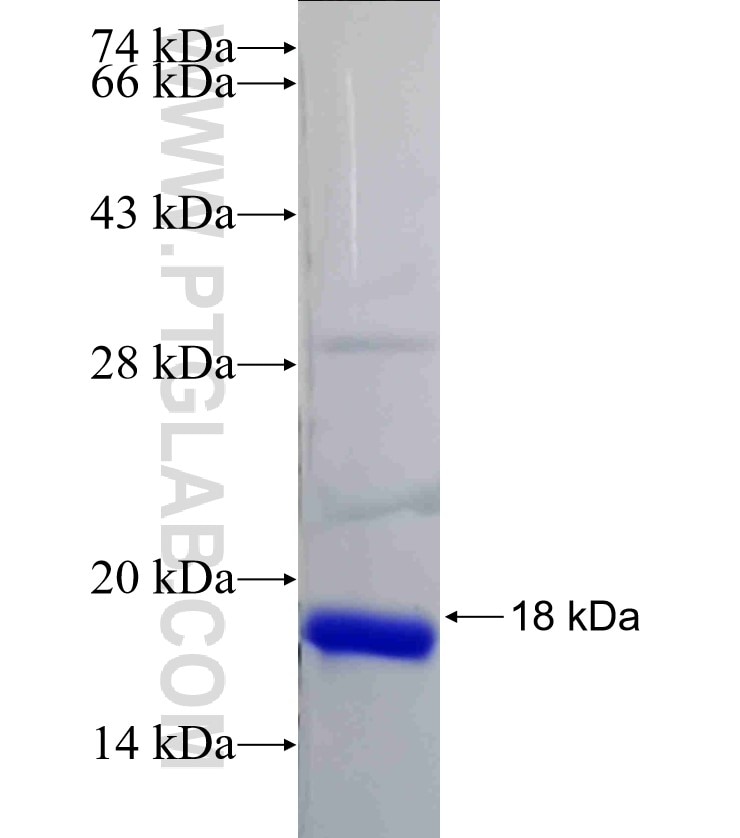 ubiquitin fusion protein Ag20753 SDS-PAGE