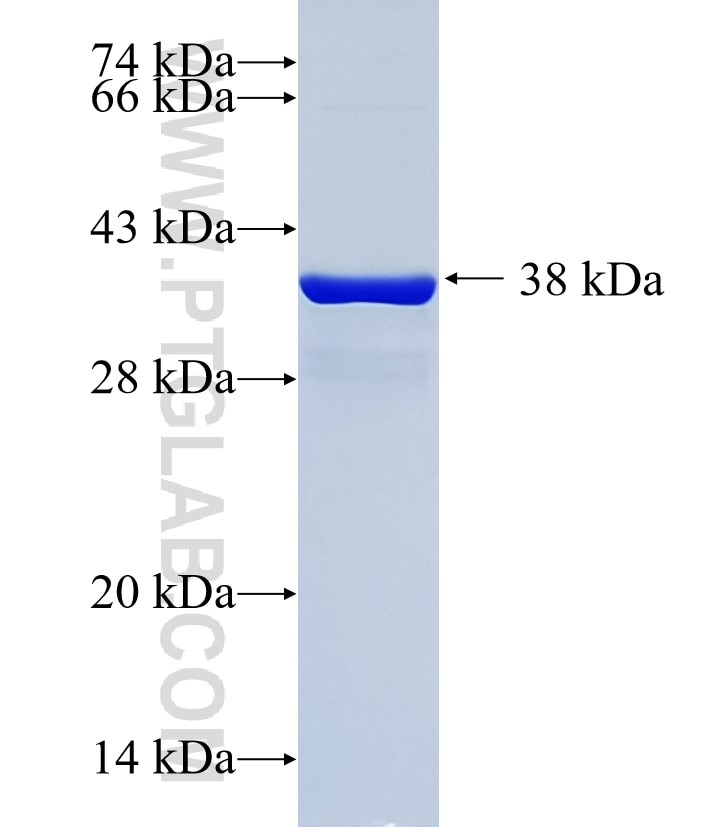 ubiquitin fusion protein Ag0260 SDS-PAGE