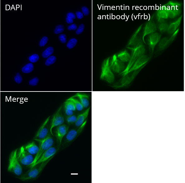 MDCK cells were immunostained with Vimentin recombinant antibody, VHH-rabbit IgG Fc fusion [CTK0211] (vfrb, 1:1,000) and Nano-Secondary? alpaca anti-human IgG/anti-rabbit IgG, recombinant VHH, Alexa Fluor? 647 [CTK0101, CTK0102] (srbAF647-1, 1:1,000). Scale bar, 10 μM.