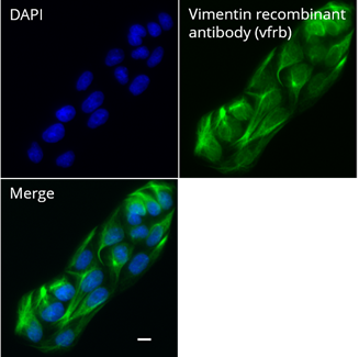 MDCK cells were immunostained with Vimentin recombinant antibody, VHH-rabbit IgG Fc fusion [CTK0211] (vfrb, 1:1,000) and Nano-Secondary® alpaca anti-human IgG/anti-rabbit IgG, recombinant VHH, Alexa Fluor® 647 [CTK0101, CTK0102] (srbAF647-1, 1:1,000). Scale bar, 10 μm.