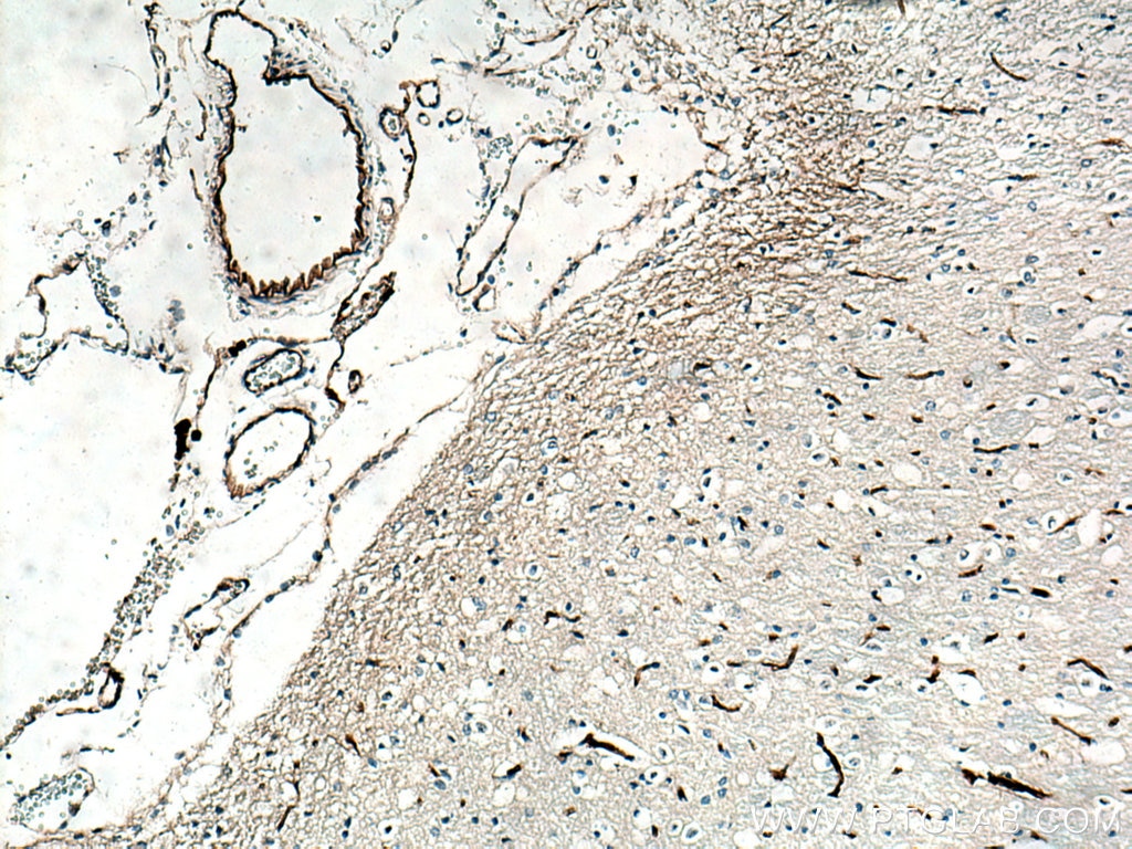 Immunohistochemistry (IHC) staining of rat brain tissue using VWF Polyclonal antibody (27186-1-AP)
