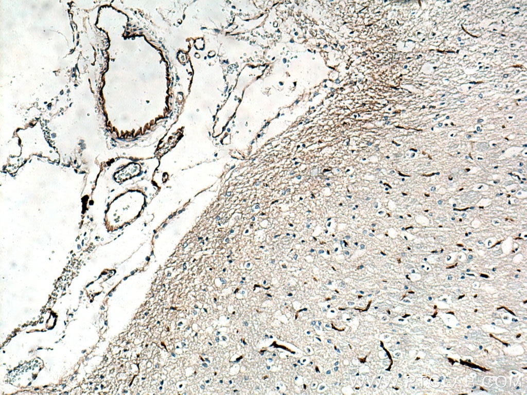 IHC staining of rat brain using 27186-1-AP