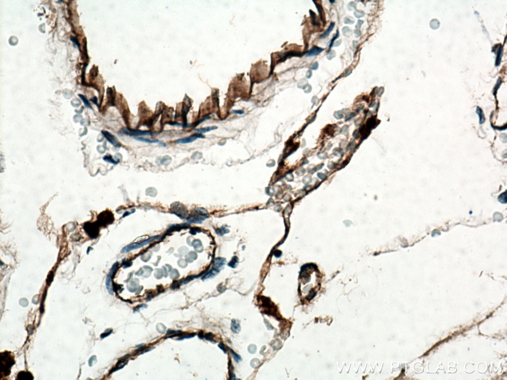 Immunohistochemistry (IHC) staining of rat brain tissue using VWF Polyclonal antibody (27186-1-AP)