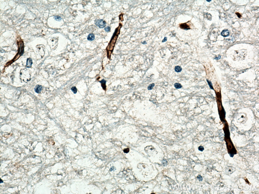 Immunohistochemistry (IHC) staining of rat brain tissue using VWF Polyclonal antibody (27186-1-AP)