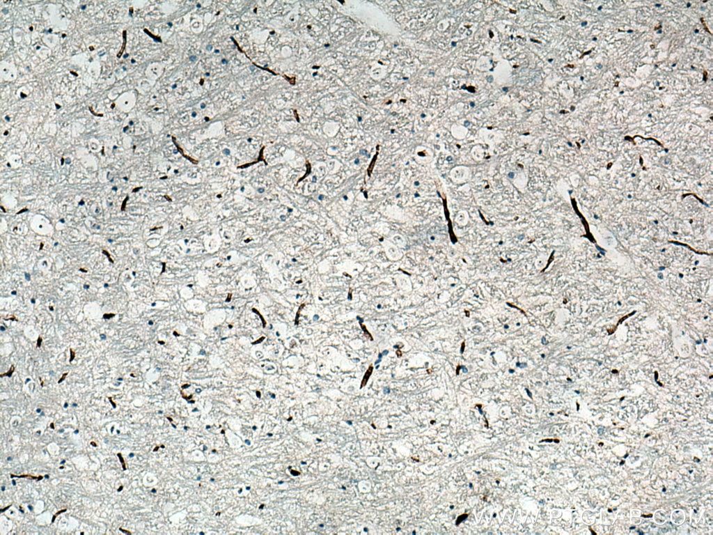 Immunohistochemistry (IHC) staining of rat brain tissue using VWF Polyclonal antibody (27186-1-AP)