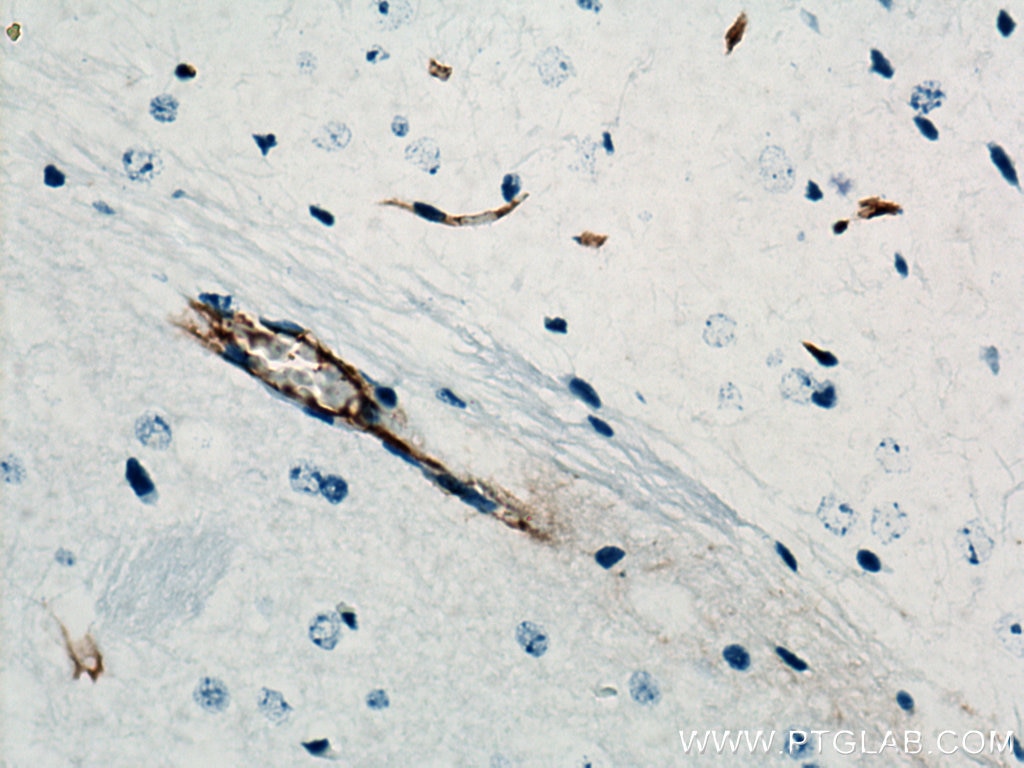 Immunohistochemistry (IHC) staining of mouse brain tissue using VWF Polyclonal antibody (27186-1-AP)