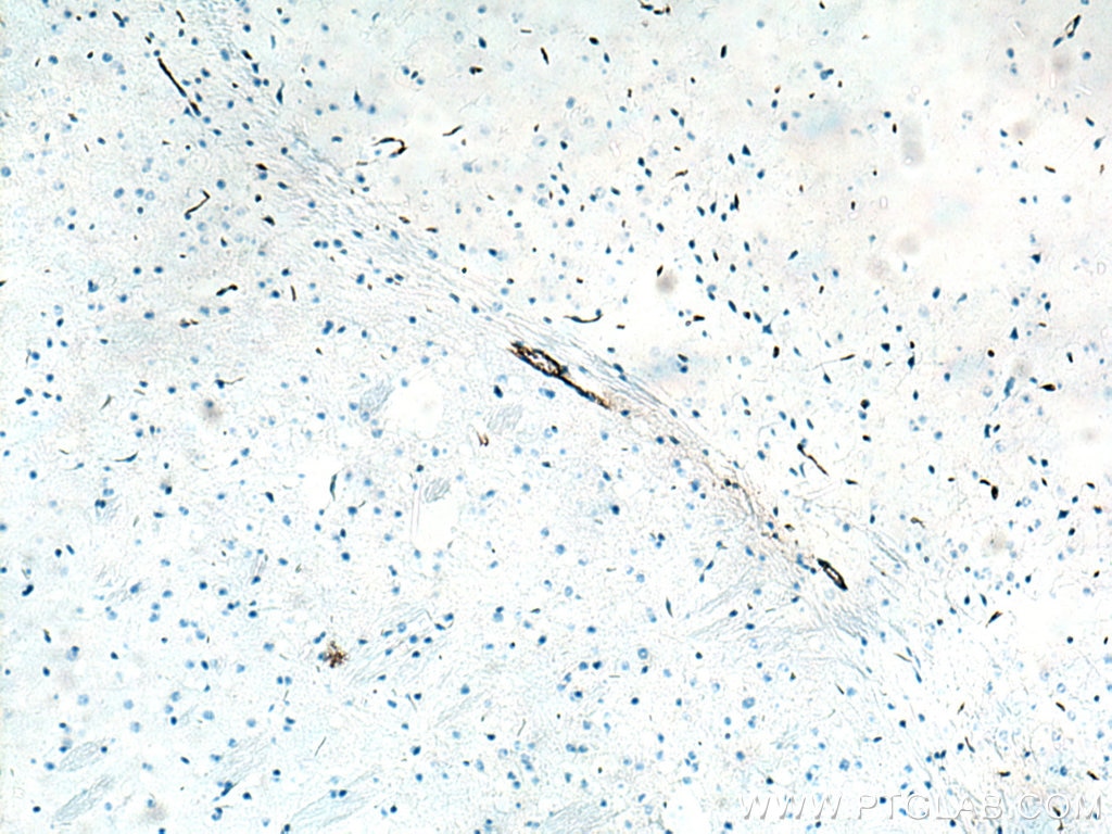 Immunohistochemistry (IHC) staining of mouse brain tissue using VWF Polyclonal antibody (27186-1-AP)