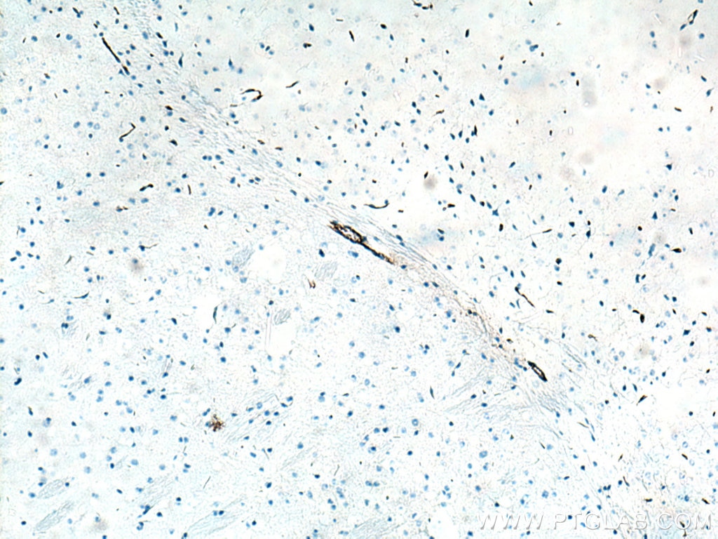 IHC staining of mouse brain using 27186-1-AP