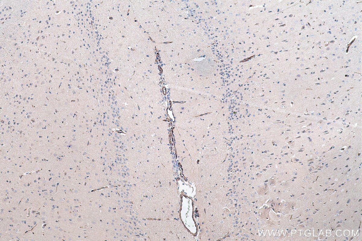 Immunohistochemistry (IHC) staining of rat brain tissue using VWF Polyclonal antibody (27186-1-AP)