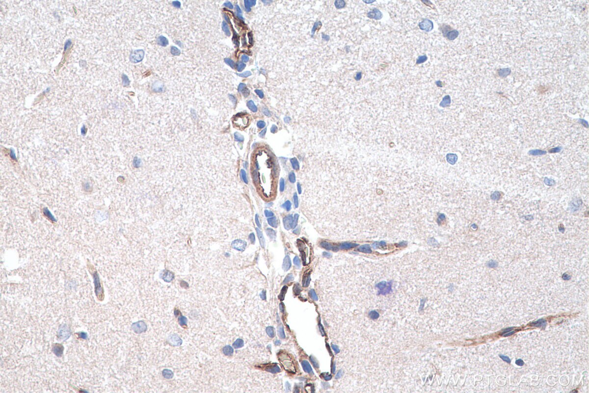 Immunohistochemistry (IHC) staining of rat brain tissue using VWF Polyclonal antibody (27186-1-AP)