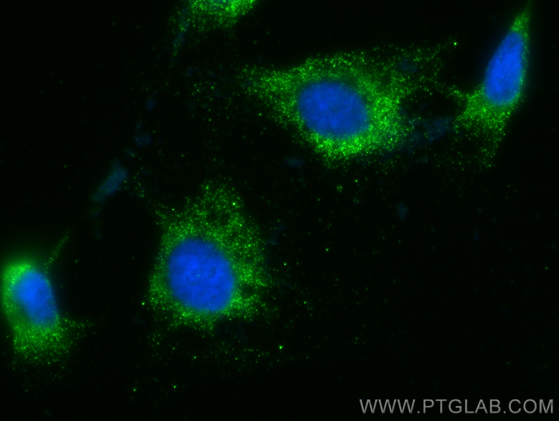 Immunofluorescence (IF) / fluorescent staining of HUVEC cells using VWF Monoclonal antibody (66682-1-Ig)