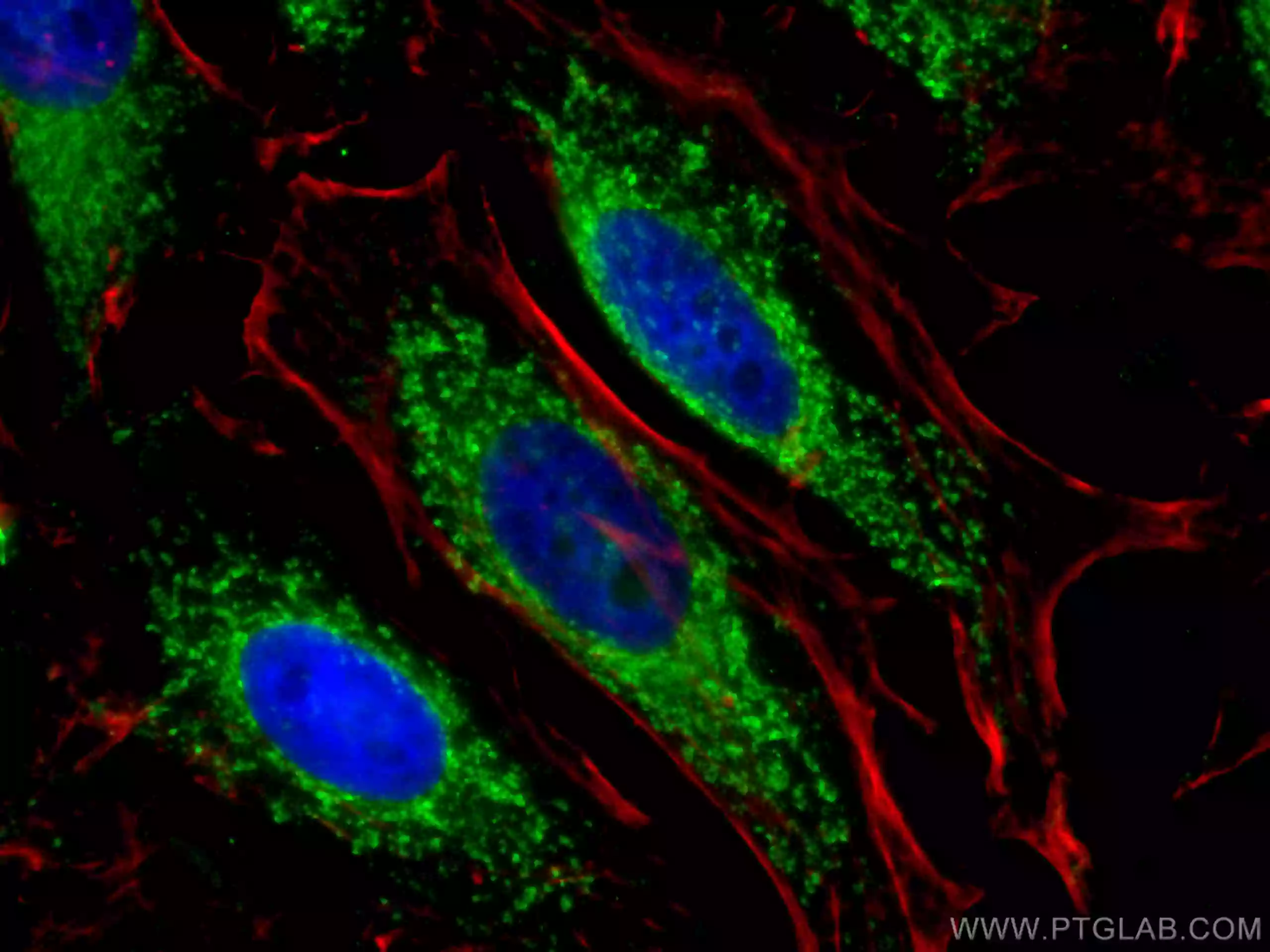 Immunofluorescent analysis of  fixed HeLa cells using AIF antibody