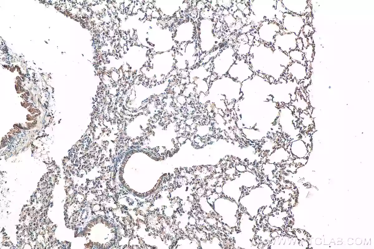 IHC analysis of mouse lung using BAX antibody