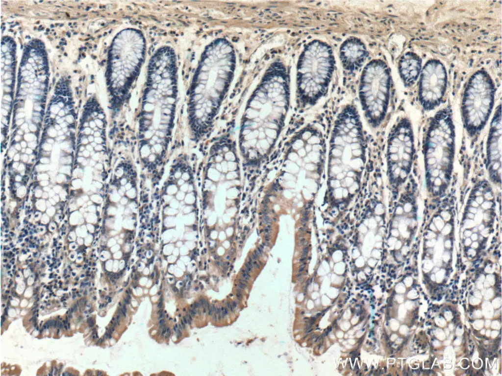 Immunohistochemistry (IHC) staining of human colon using Bcl-XL polyclonal antibody