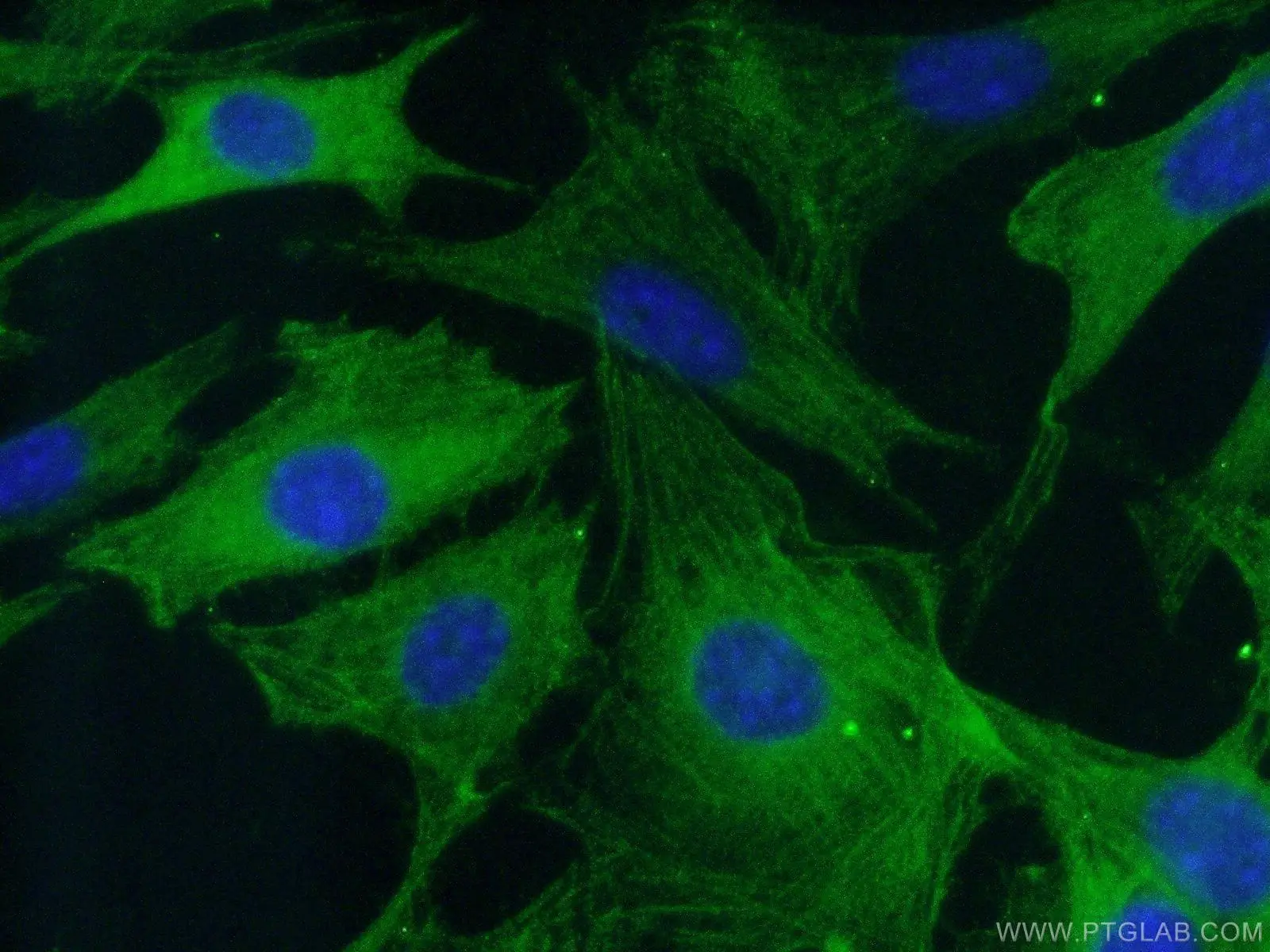 Immunofluorescent analysis of fixed NIH/3T3 cells using Caspase 3 antibody