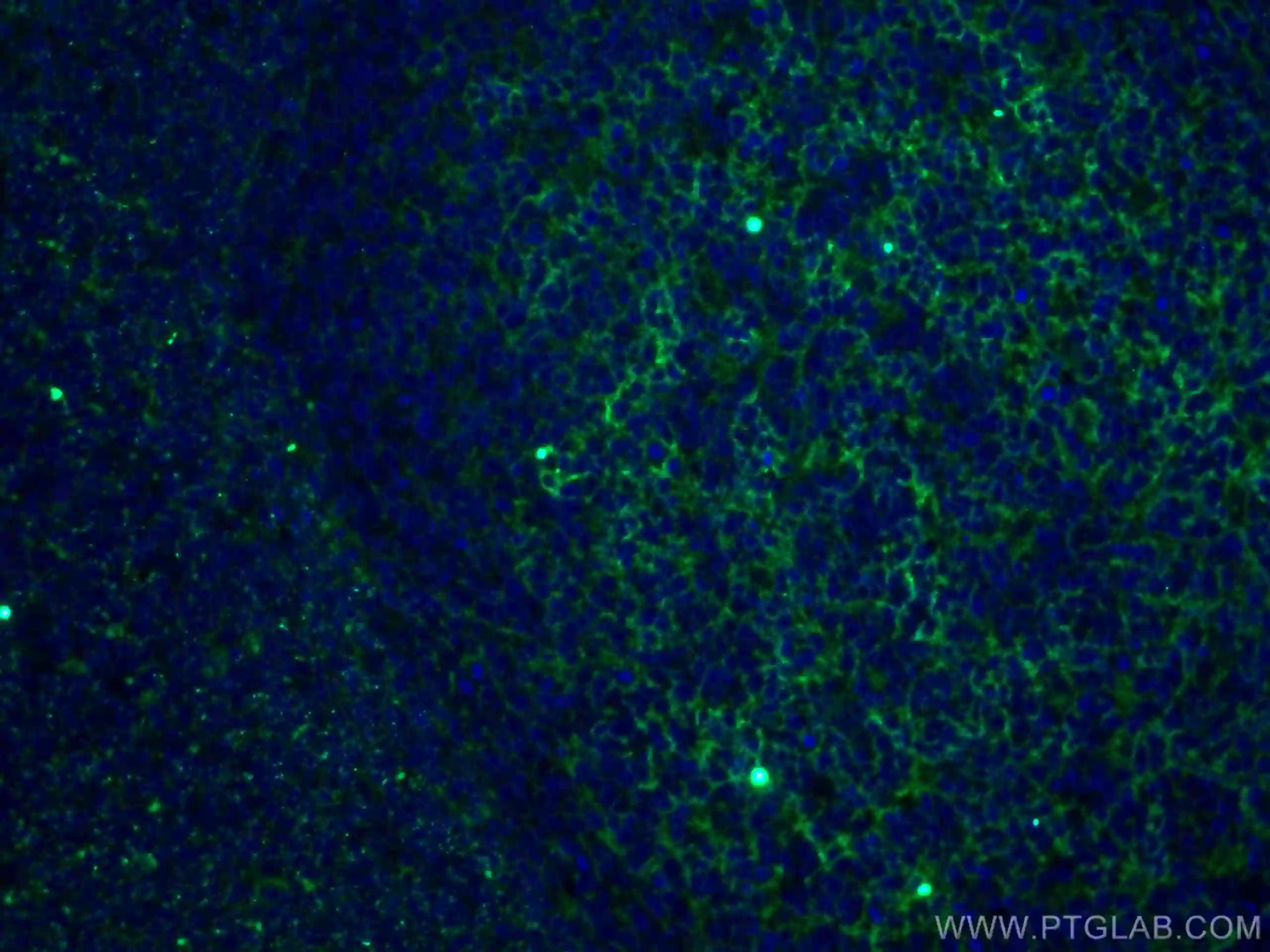 Immunofluorescent analysis of (4% PFA) fixed human tonsillitis tissue using 66519-1-Ig (CD11B/Integrin alpha M antibody) at dilution of 1:100 and CoraLite488-Conjugated AffiniPure Goat Anti-Mouse IgG(H+L).