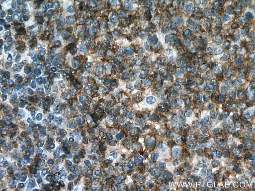 IHC staining of human tonsilitis tissue using proteintech's CD19 antibody 66298-1-IG