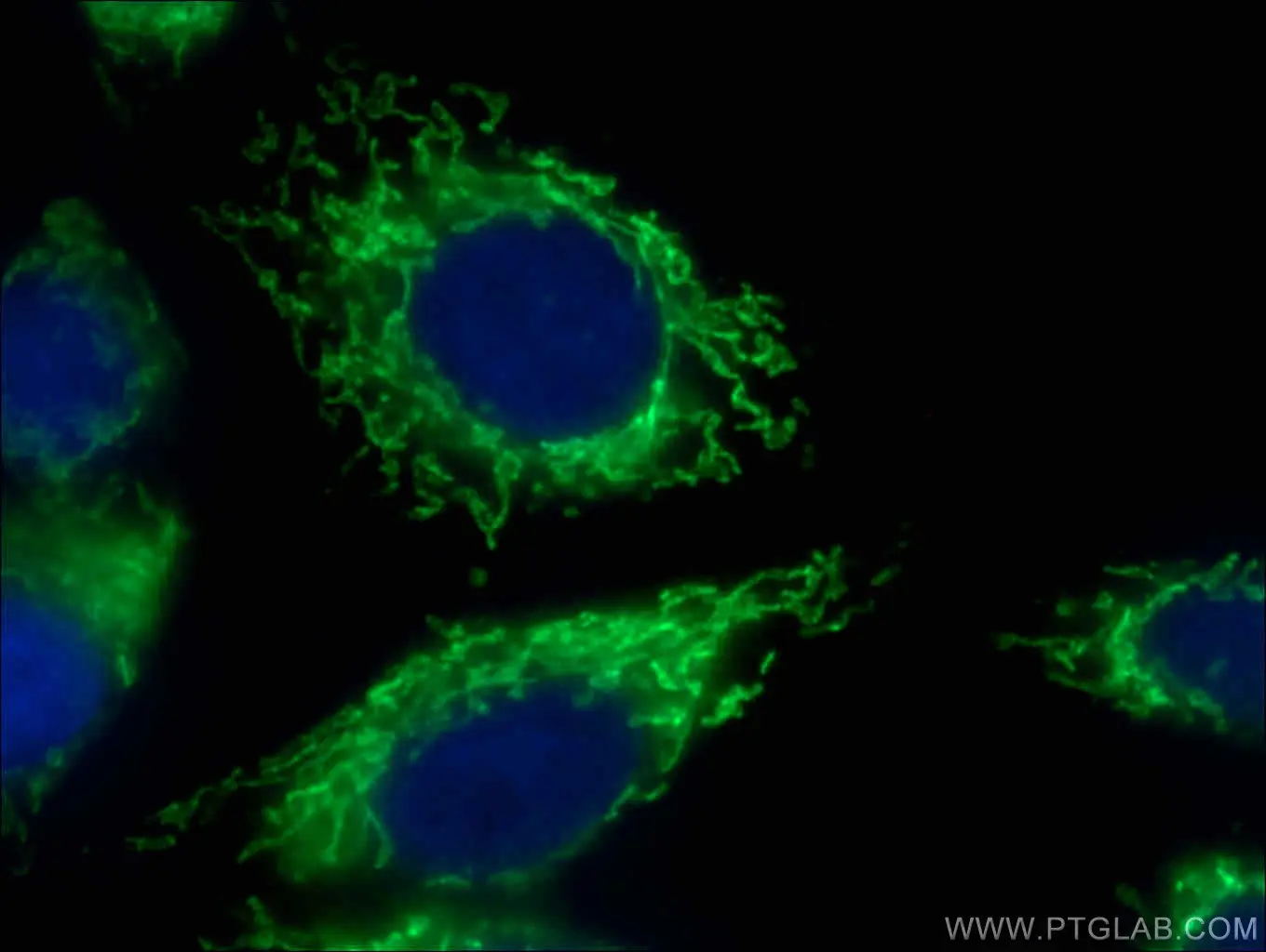 IF analysis of HepG2 cells using COXIV (11242-1-AP) antibody at a dilution of 1:50 and Alexa Fluor 488-Conjugated AffiniPure Goat Anti-Rabbit IgG(H+L).