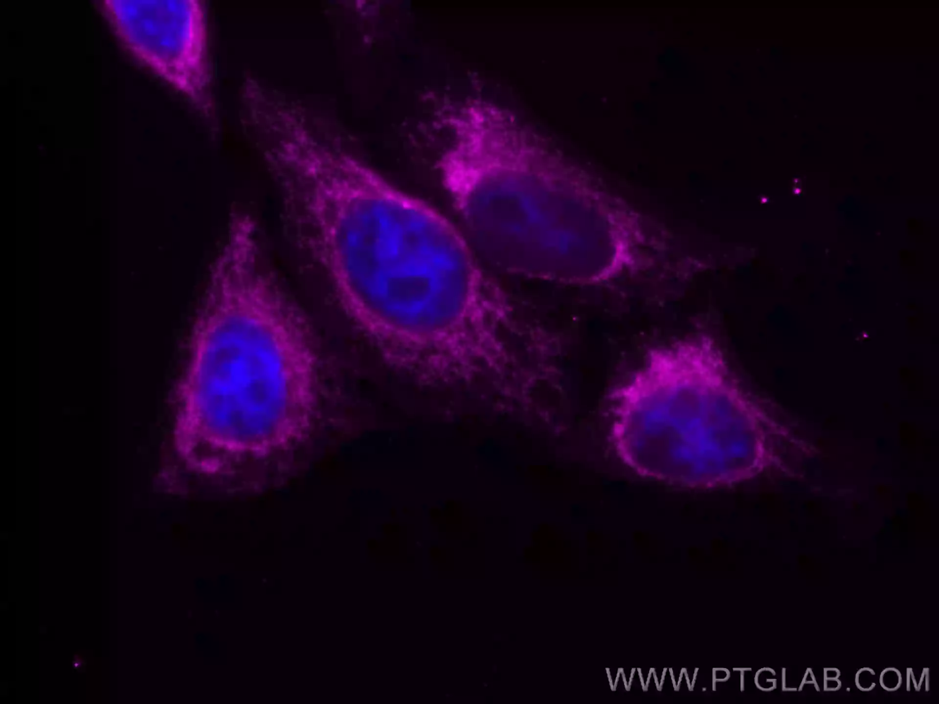 What Is A Sub PreOut? PreOuts Explained, 50 OFF