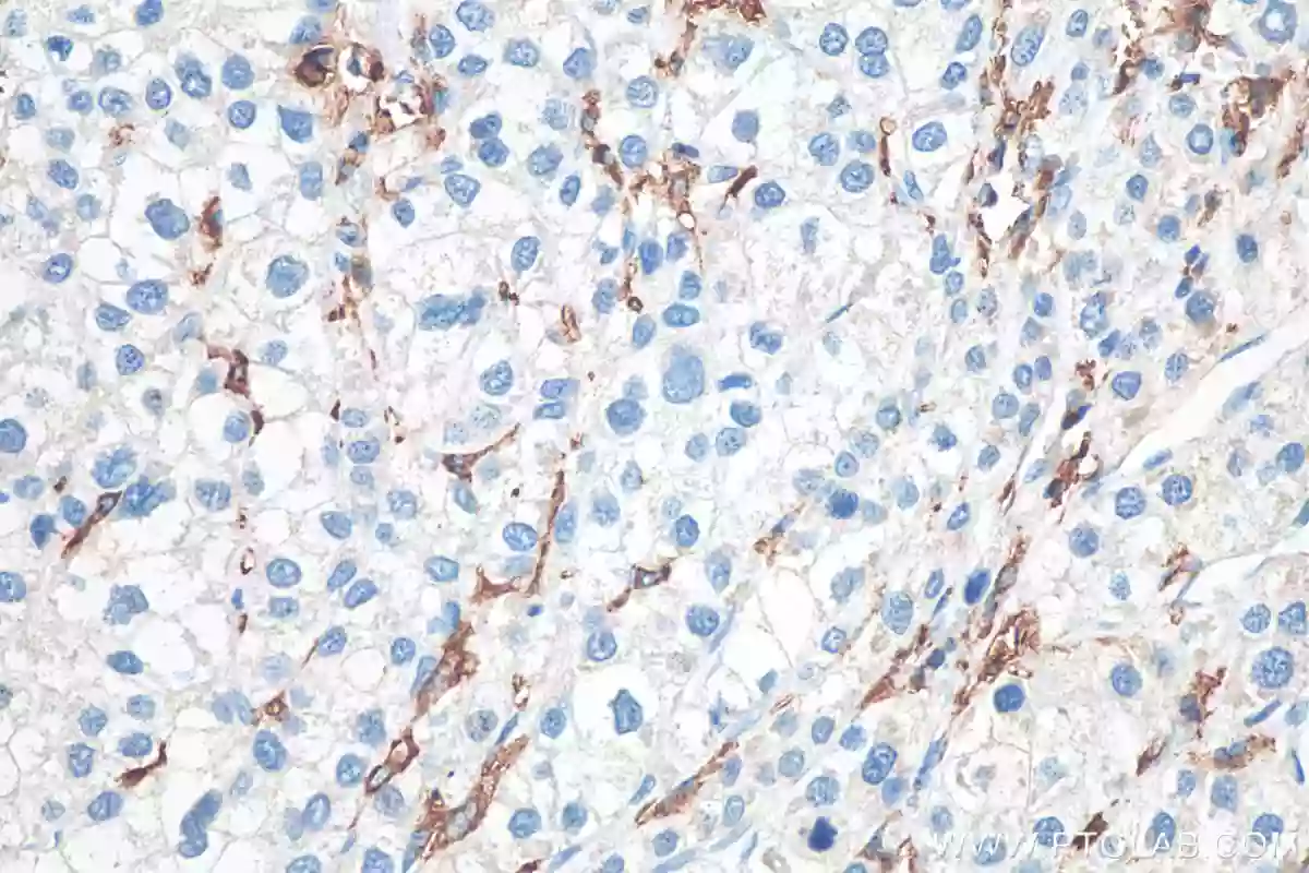 cd3129010