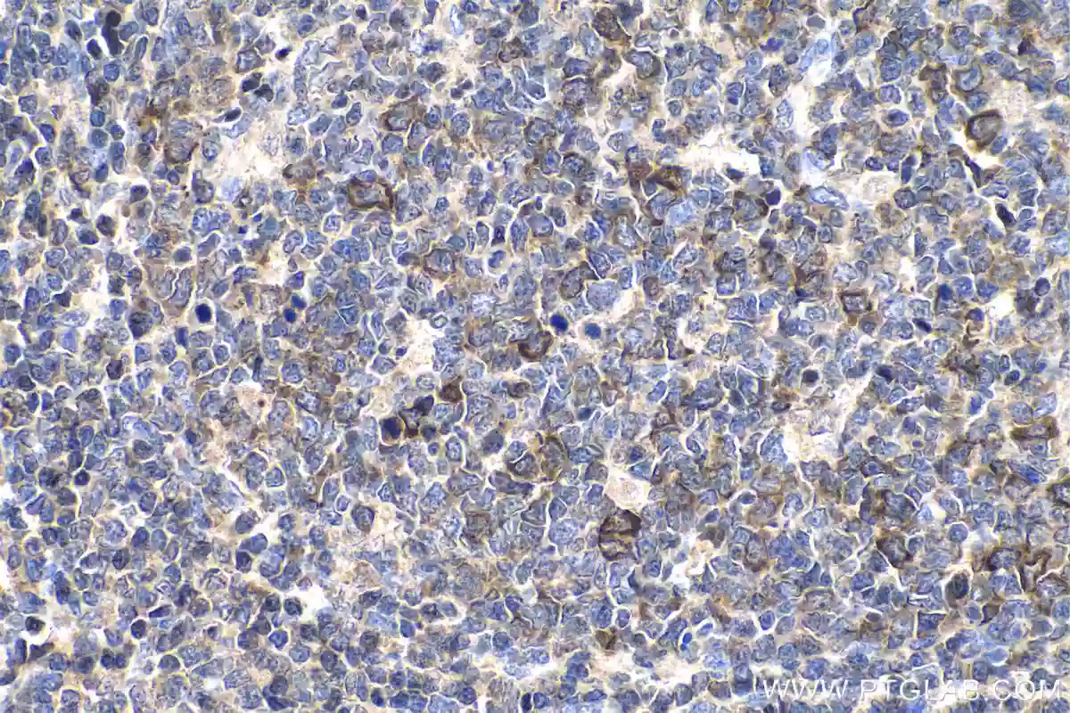 Immunohistochemical analysis of paraffin-embedded human tonsillitis tissue slide using 28603-1-AP Cyclin B1 antibody