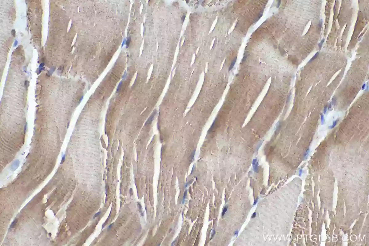 FBXO32 antibody (67172-1-Ig) | Proteintech
