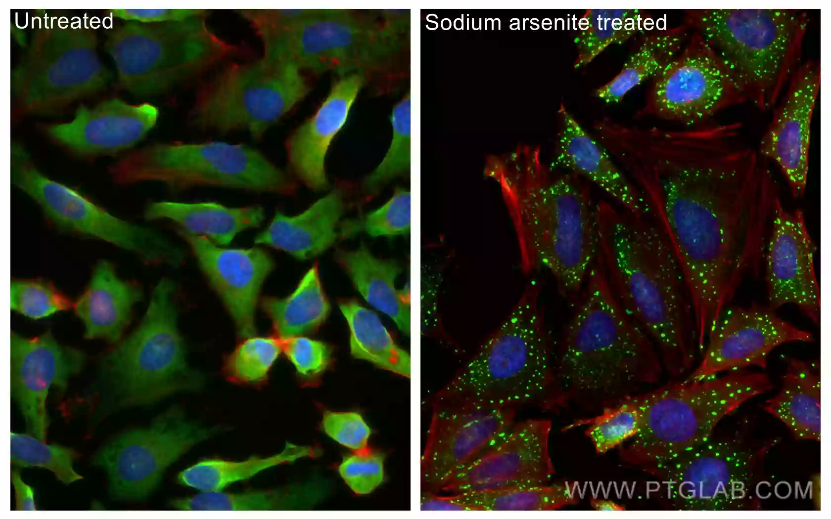 Immunofluorescence (IF) staining of HeLa using CoraLite®488-conjugated G3BP1 Polyclonal antibody (CL488-13057)
                                                                          
