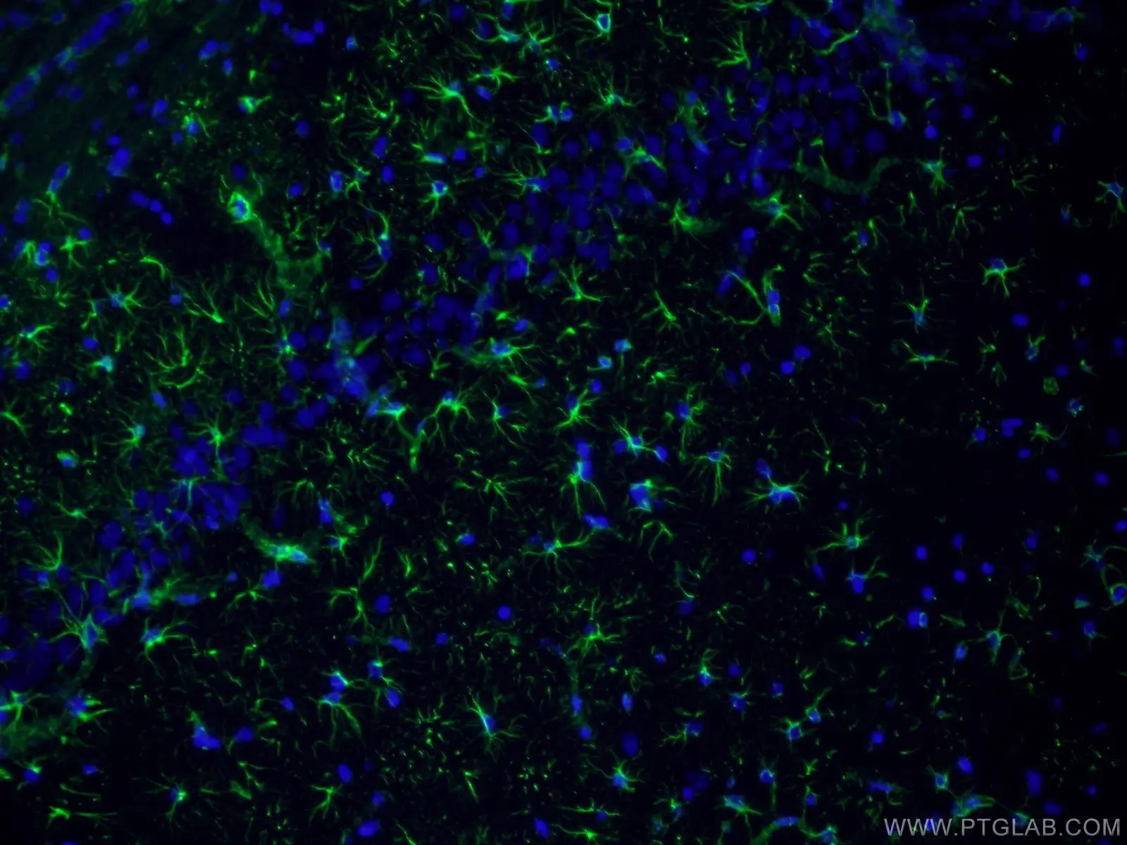 Immunofluorescent analysis of fixed mouse brain tissue using GFAP antibody