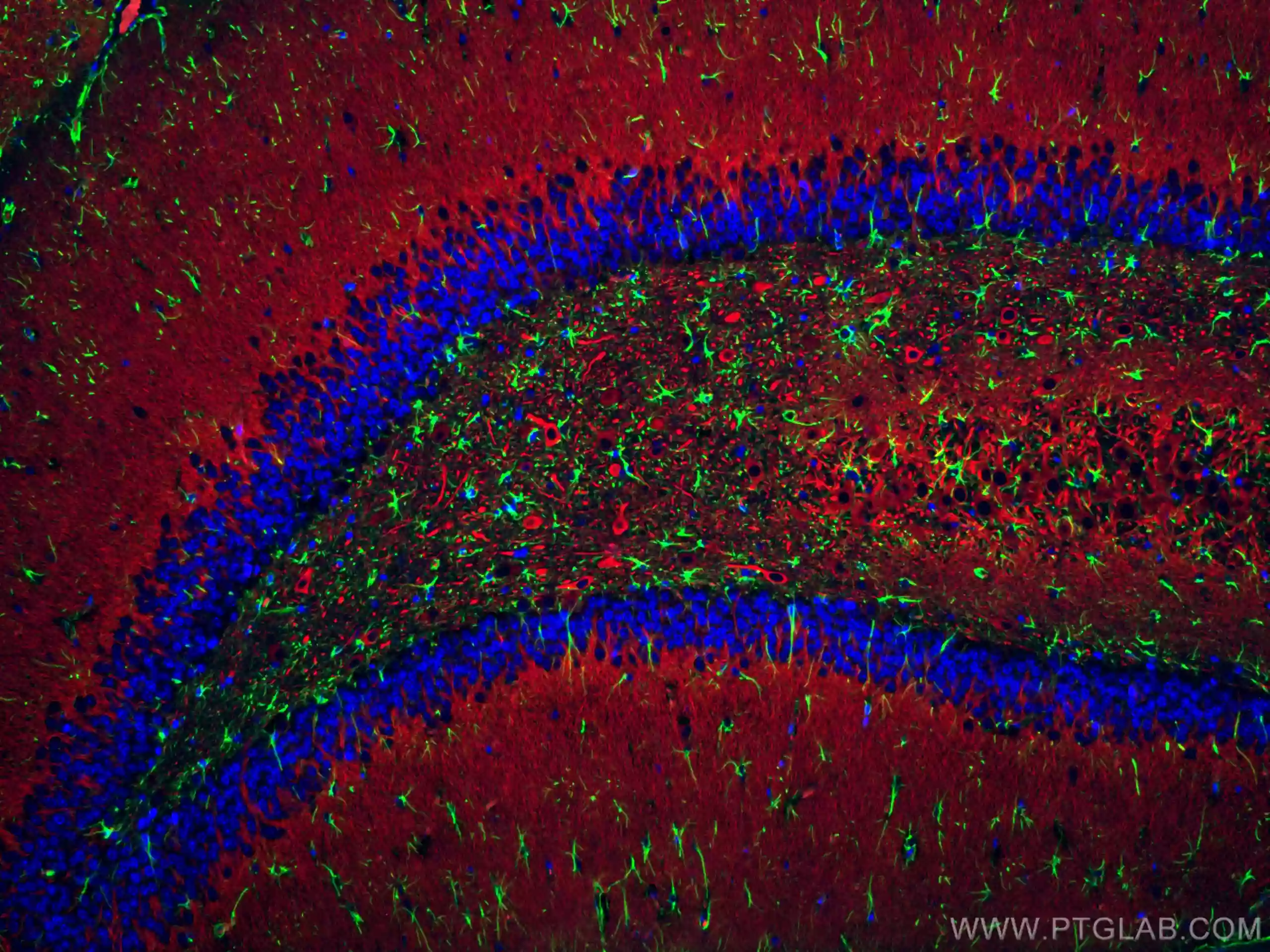 Immunofluorescent staining of rat brain using Proteintech's CoraLite Plus 488 GFAP antibody (CL488-16825, green), CoraLite 594 MAP2 antibody (CL594-17490, red), and DAPI (blue)