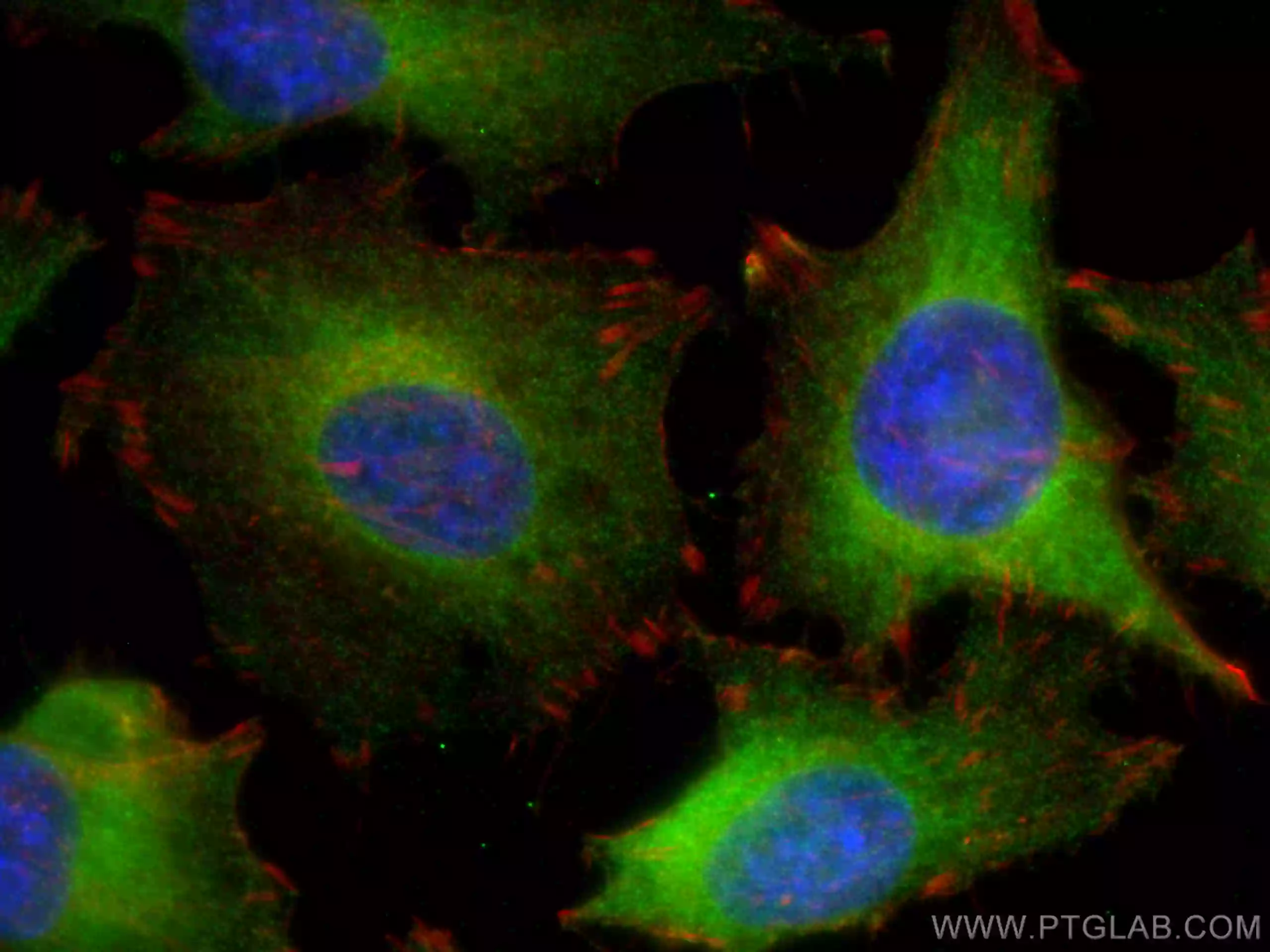 Immunofluorescent analysis of fixed HeLa cells using Beta Galactosidase antibody (15518-1-AP) and CoraLite®488-Conjugated  IgG(H+L), CL594-Phalloidin (red). 