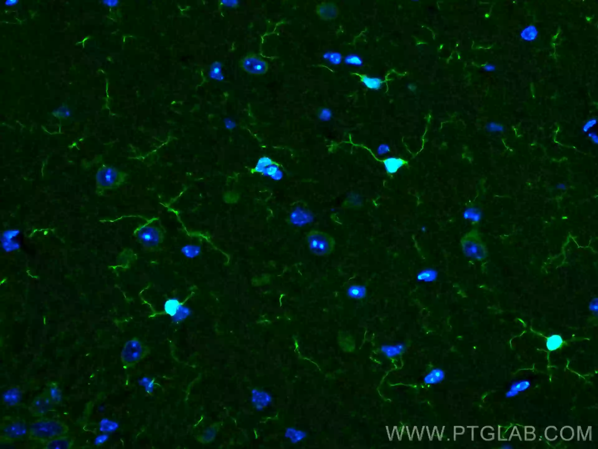Immunofluorescent analysis of (4% PFA) fixed rat brain tissue