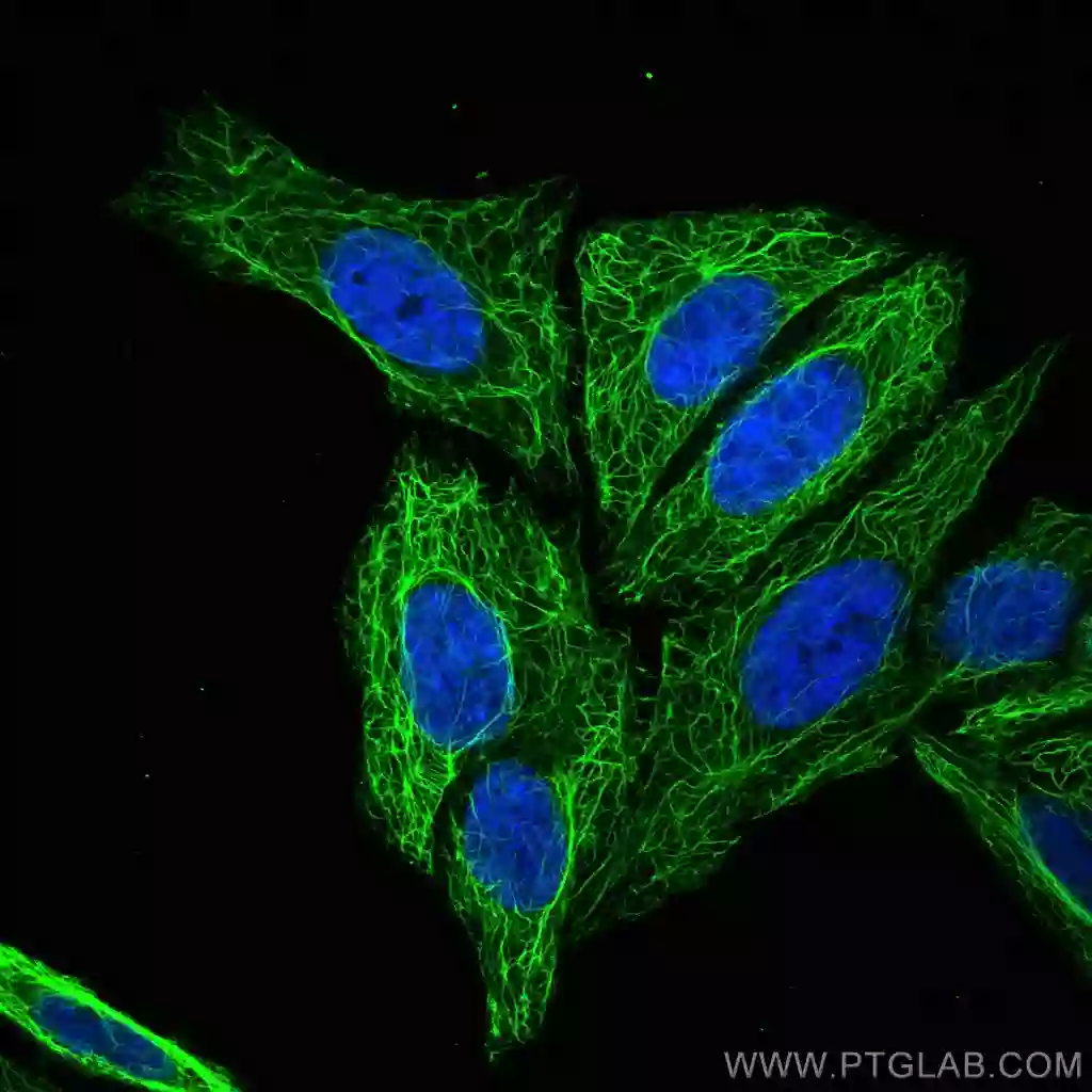 Cytokeratin 17-Specific antibody (17516-1-AP) | Proteintech