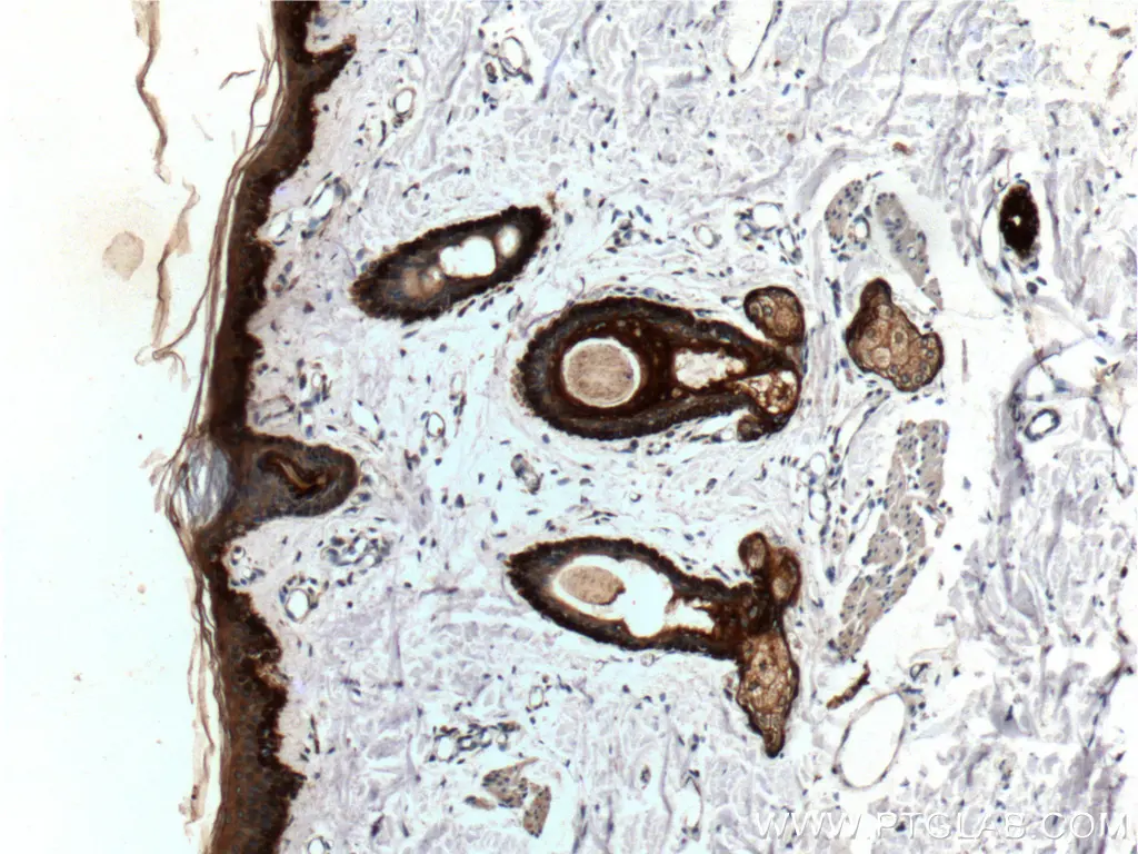 Cytokeratin 19 antibody (10712-1-AP) | Proteintech