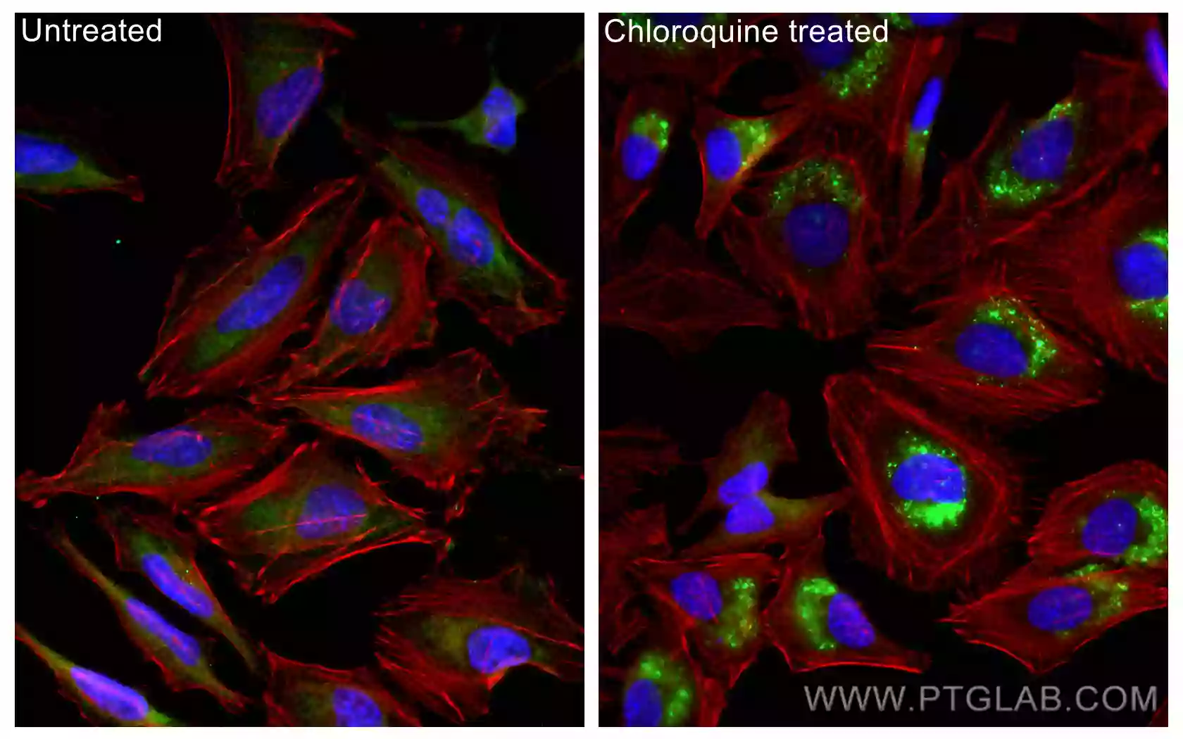 IF analysis of untreated or chloroquine-treated HeLa cells using LC3 antibody (14600-1-AP) at a dilution of 1:500 and CoraLite®488-Conjugated AffiniPure Goat Anti-Rabbit IgG(H+L).