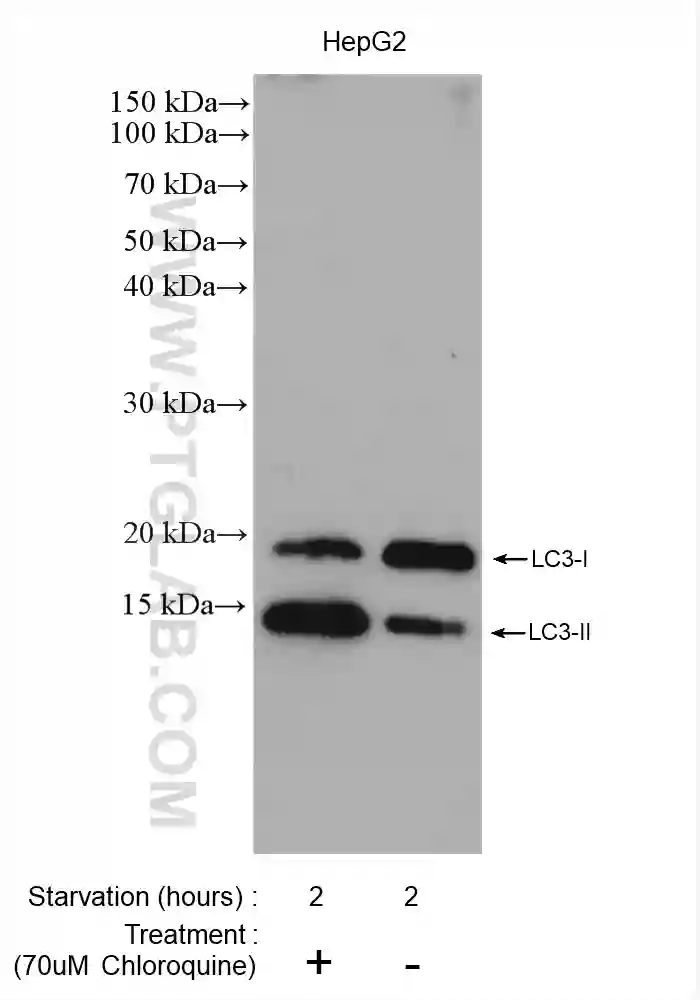 Chloroquine-treated HepG2 cells (left) and untreated HepG2 cells (right) were serum deprived for 2 hours and subjected to SDS PAGE followed by western blot with LC3 antibody (14600-1-AP) at a dilution of 1:2500.