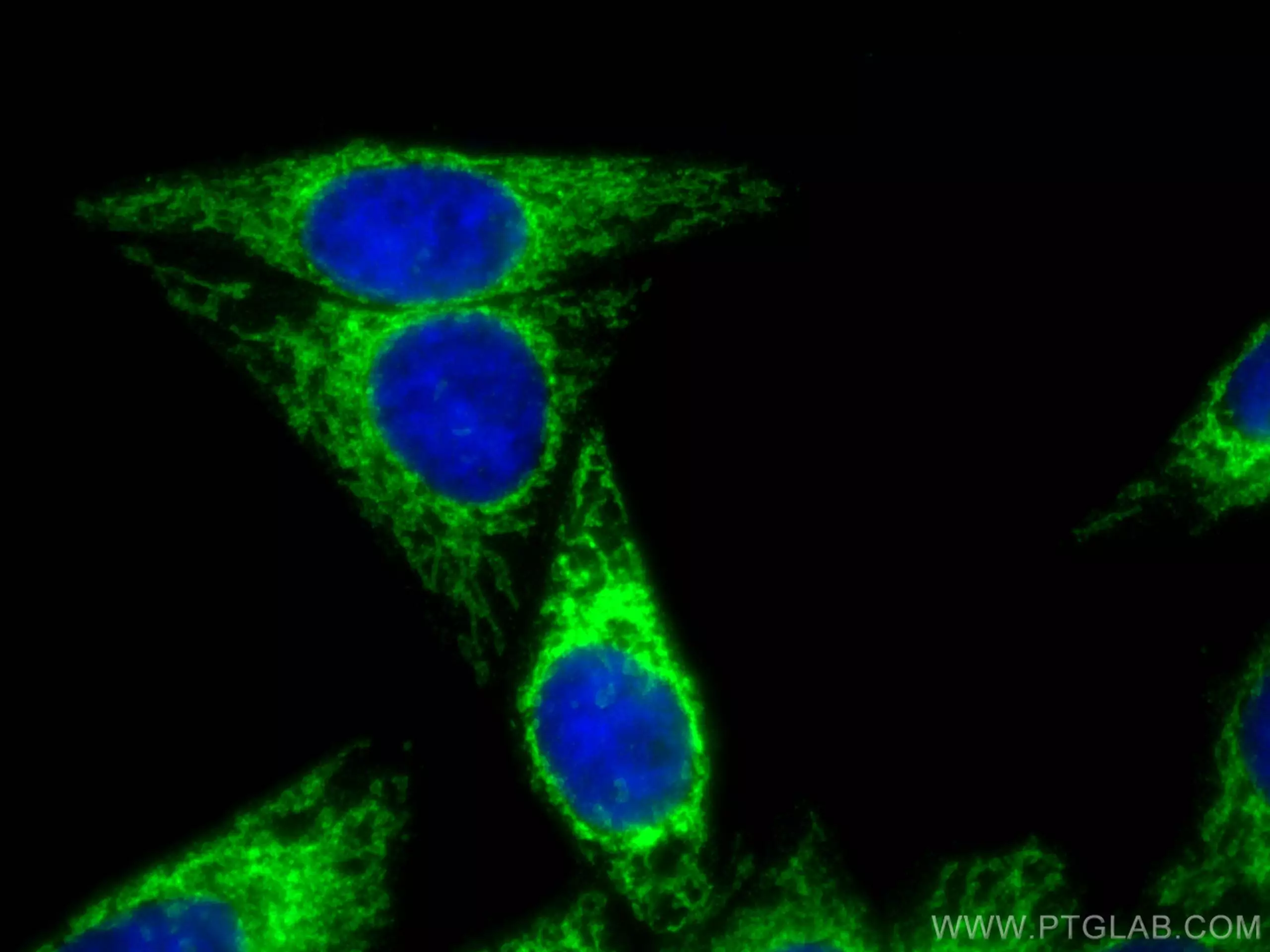 MFF抗体を用いたHepG2細胞の免疫蛍光染色像