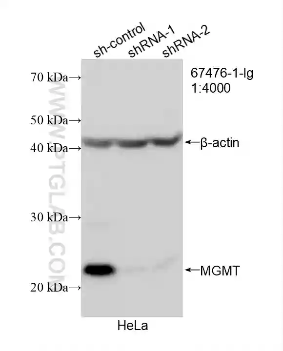 MGMT antibody (67476-1-Ig) | Proteintech