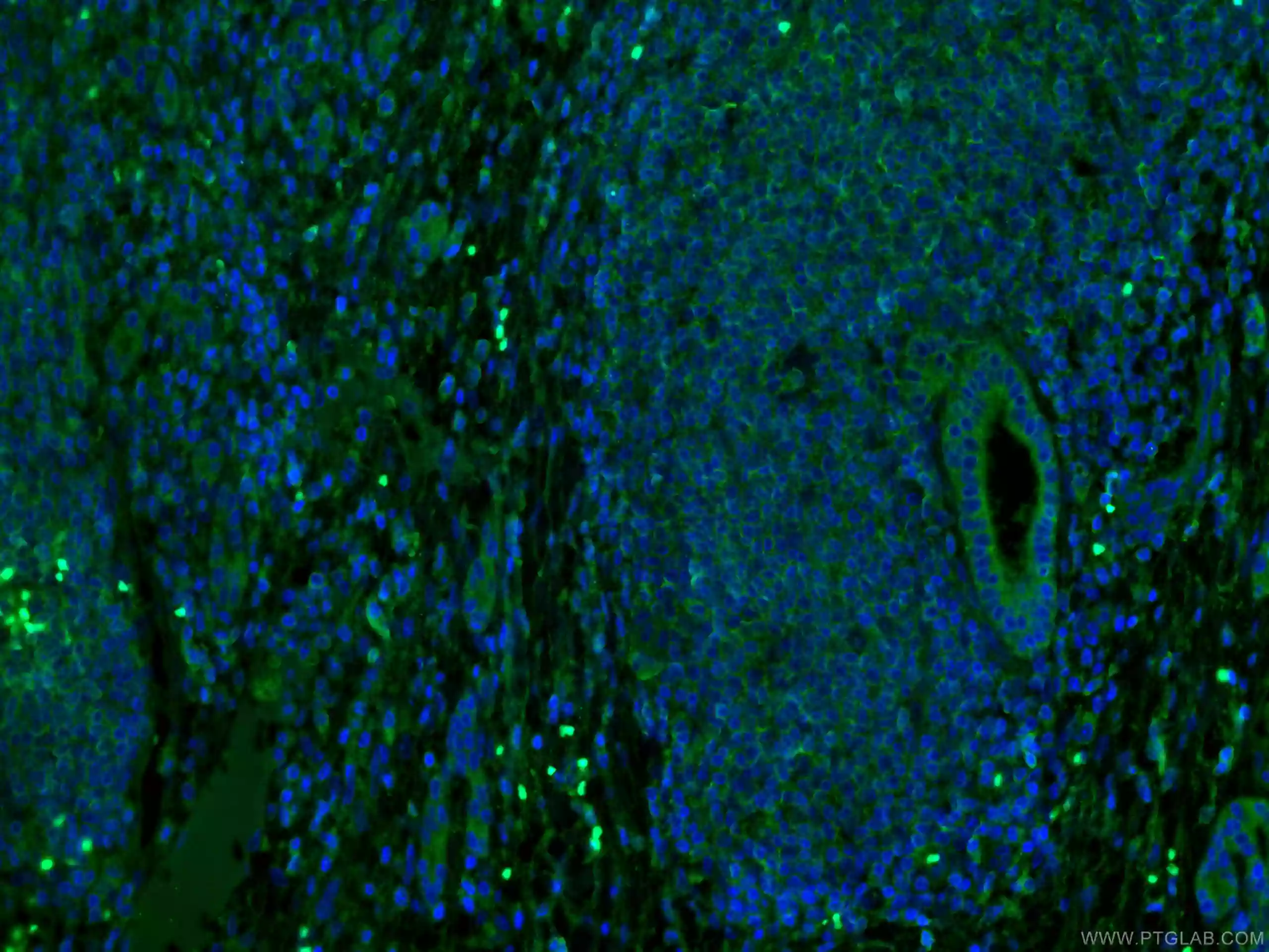 IF analysis of human liver using MLKL antibody