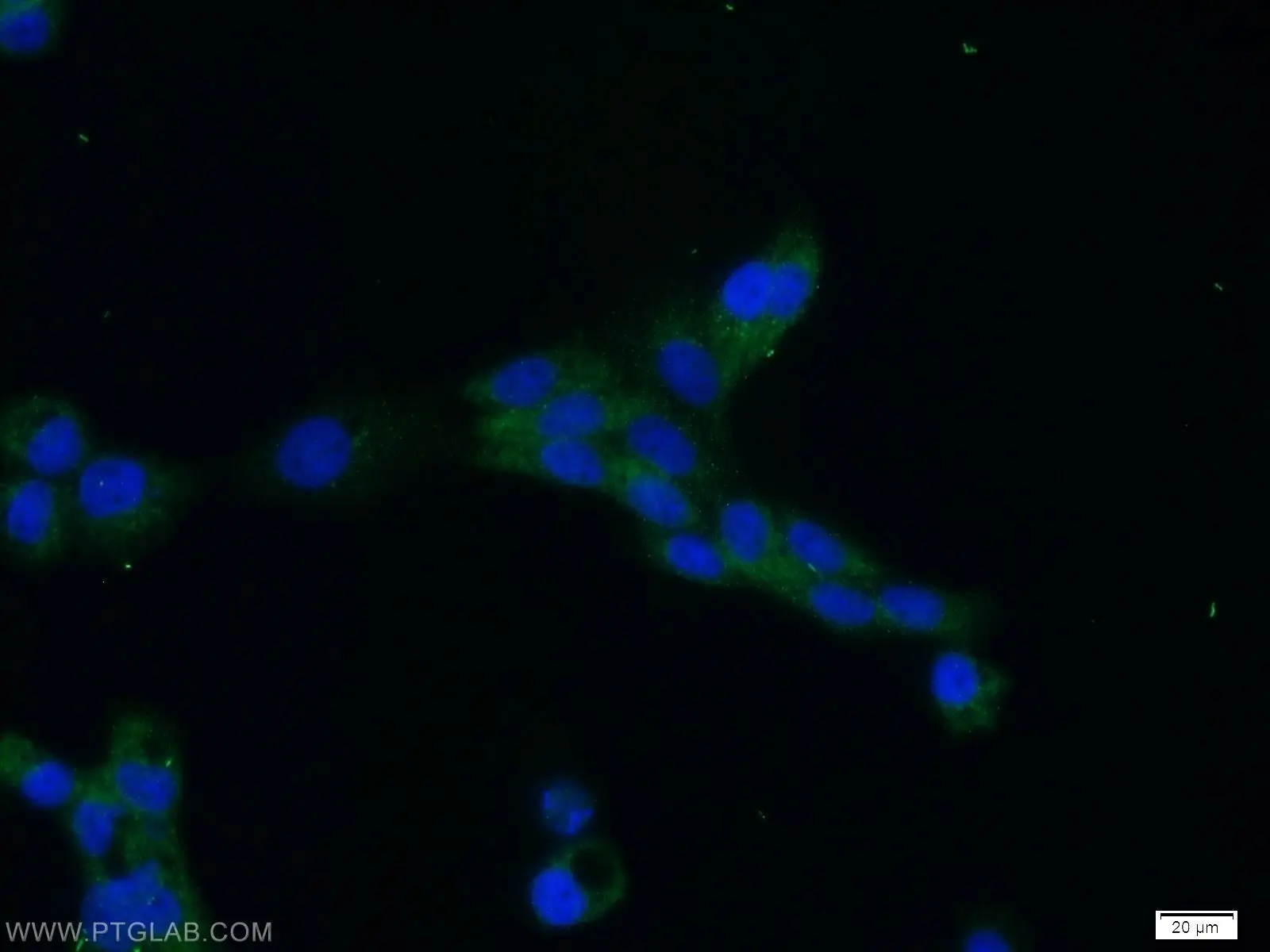 MRE11 antibody (10744-1-AP) | Proteintech