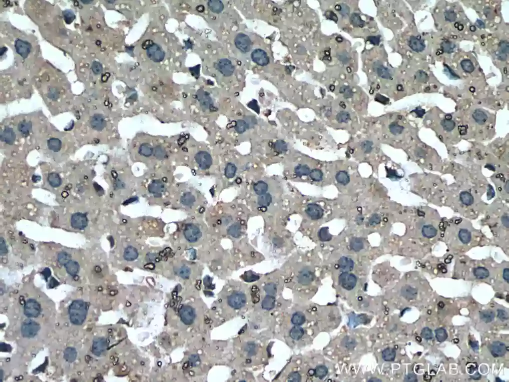 Mcp1-Antibody-66272-1-Ig-IHC-  