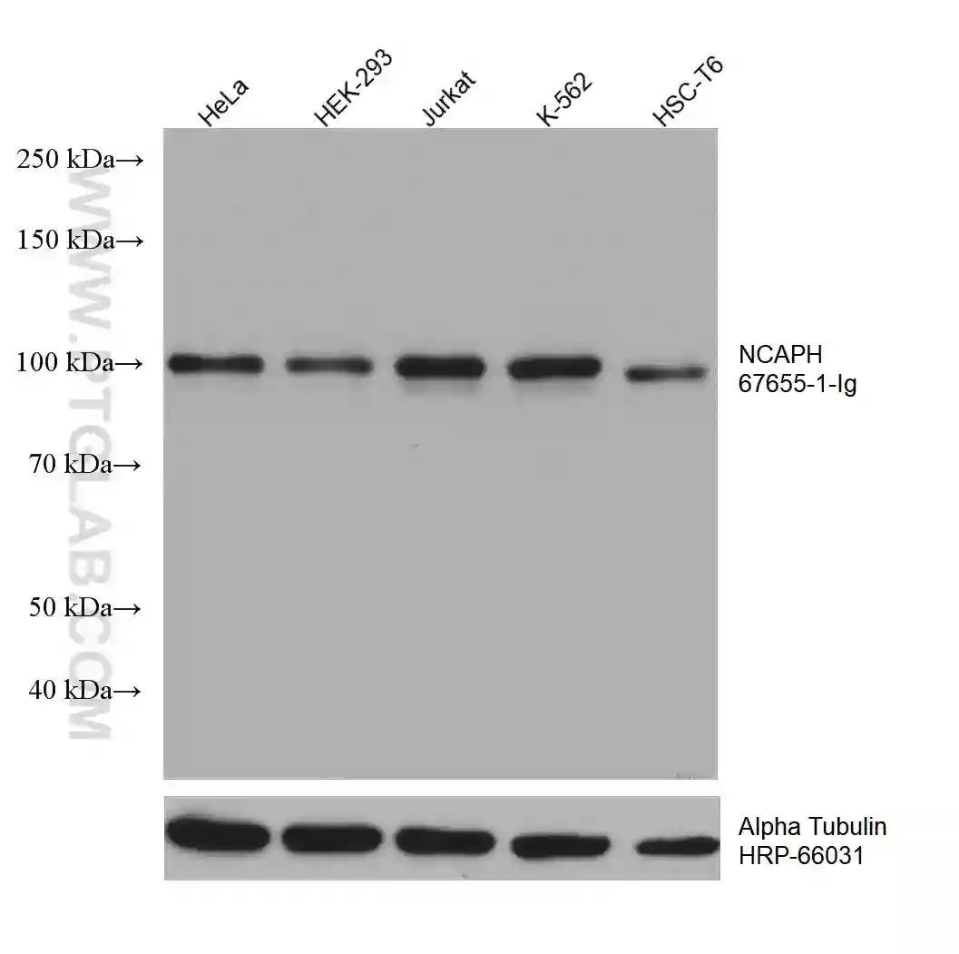 NCAPH Antikörper (67655-1-Ig) | Proteintech