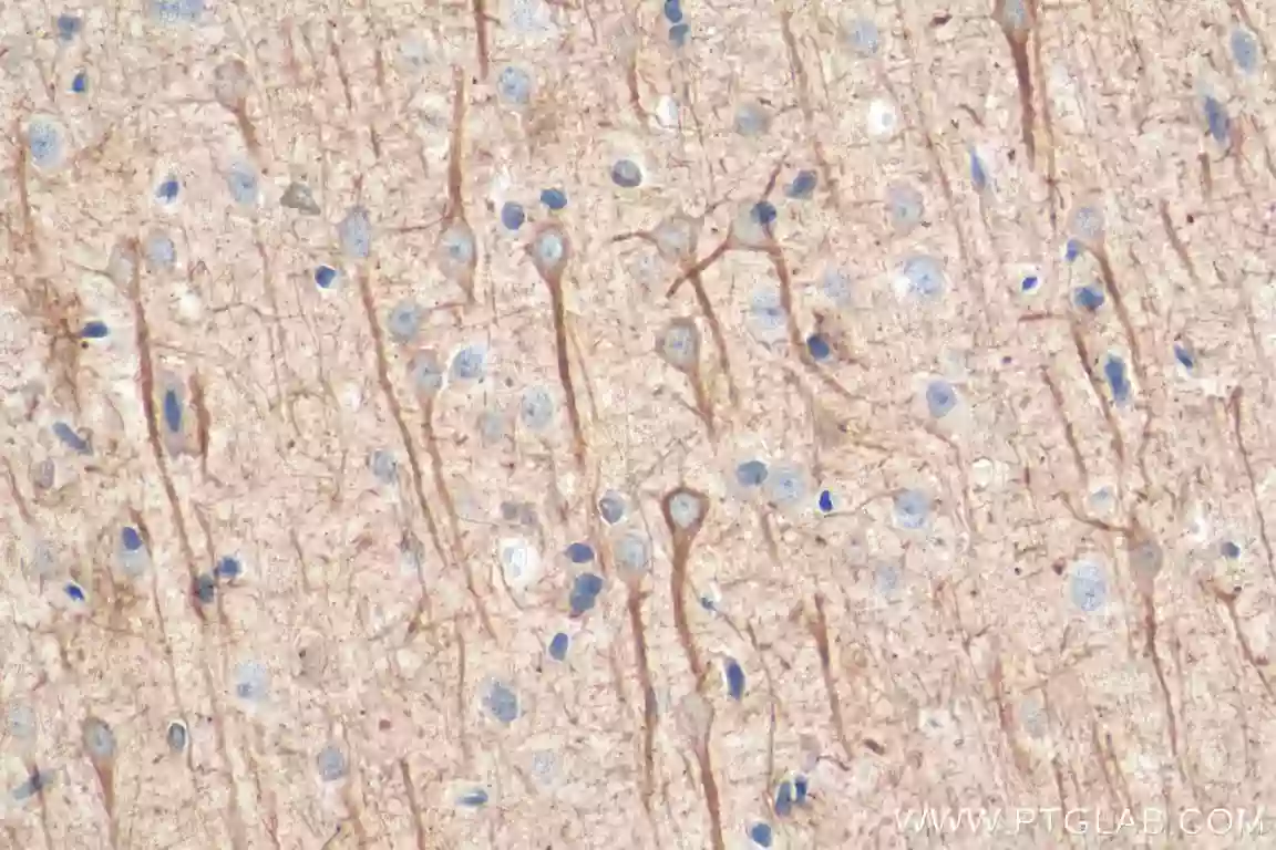 Immunohistochemical analysis of paraffin-embedded rat brain tissue slide using 60189-1-Ig (NF-L antibody)