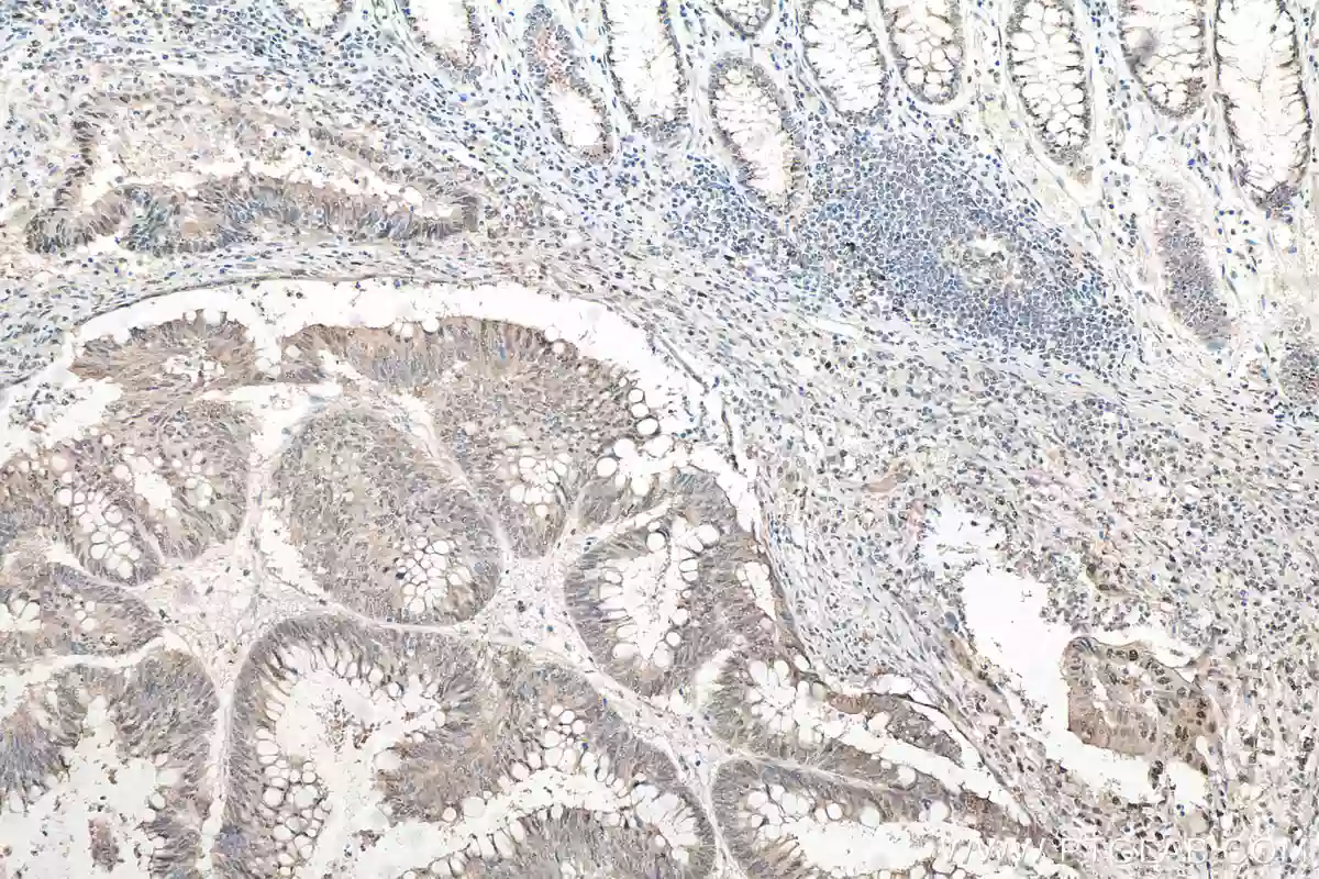 P62,SQSTM1 antibody (66184-1-Ig) Proteintech
