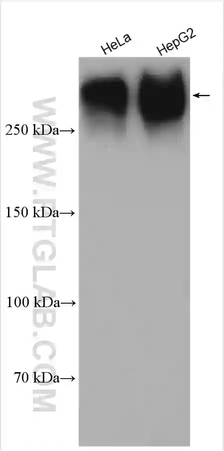 Piezo1 (extracellular domain) antibody (28511-1-AP) | Proteintech