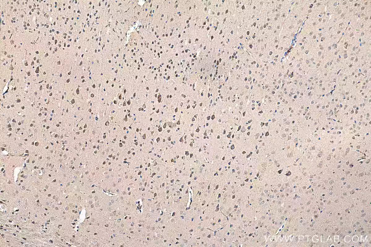 IHC analysis of paraffin-embedded mouse brain tissue using PINK1 antibody (23274-1-AP) at a dilution of 1:2000 (under 10x lens). 