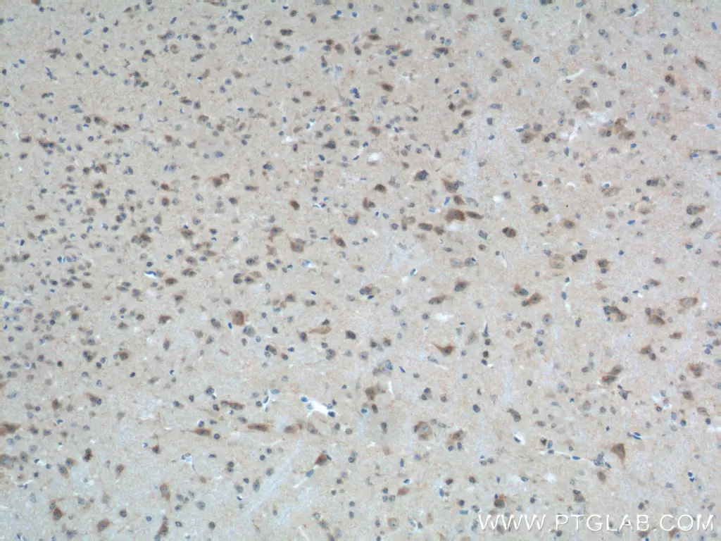 Immunohistochemical analysis of paraffin-embedded mouse brain tissue slide using 22034-1-AP (PTEN Antibody) at dilution of 1:200 (under 10x lens).