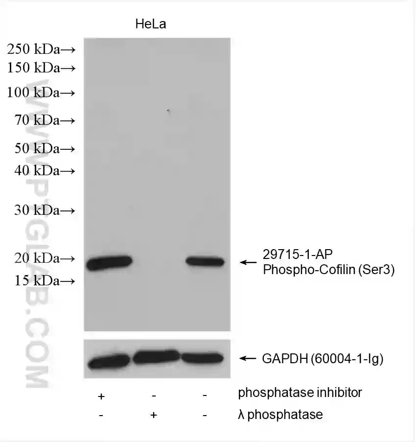 Western blot detection of phospho-Cofilin (Ser3) (29715-1-AP) and GAPDH (60004-1-Ig) in HeLa cell lysates. The addition of a phosphatase inhibitor (lane 1) increased the amount of phospho-Cofilin (Ser 3) detected compared to no inhibitor (lane 3). No band was detected for phospho-Cofilin (Ser3) after lambda phosphatase treatment of lysates (lane 2).  