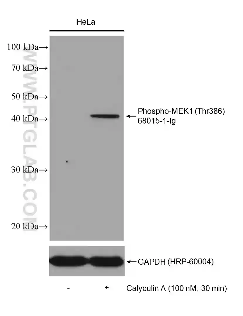 Western blot detection of Phospho-MEK1 (Thr386) (68015-1-Ig) in non-treated and Calyculin A treated HeLa cells. The membrane was stripped and reprobed for GAPDH as a loading control (HRP-66240). 