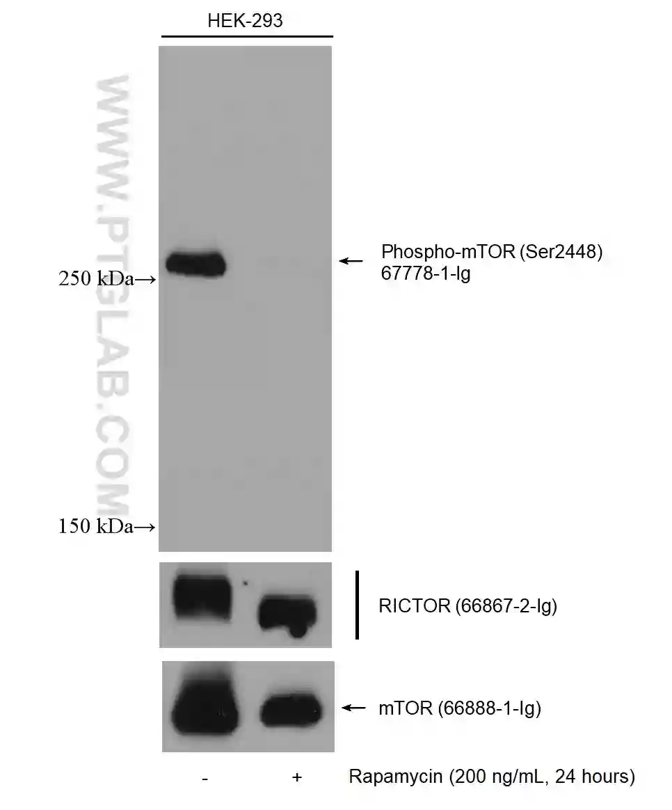 Western blot detection of Phospho-mTOR (Ser2448) (67778-1-Ig) in non-treated and rapamycin treated HEK-293 cells. The membrane was stripped and reprobed for RICTOR (66867-2-Ig) and mTOR (66888-1-Ig).