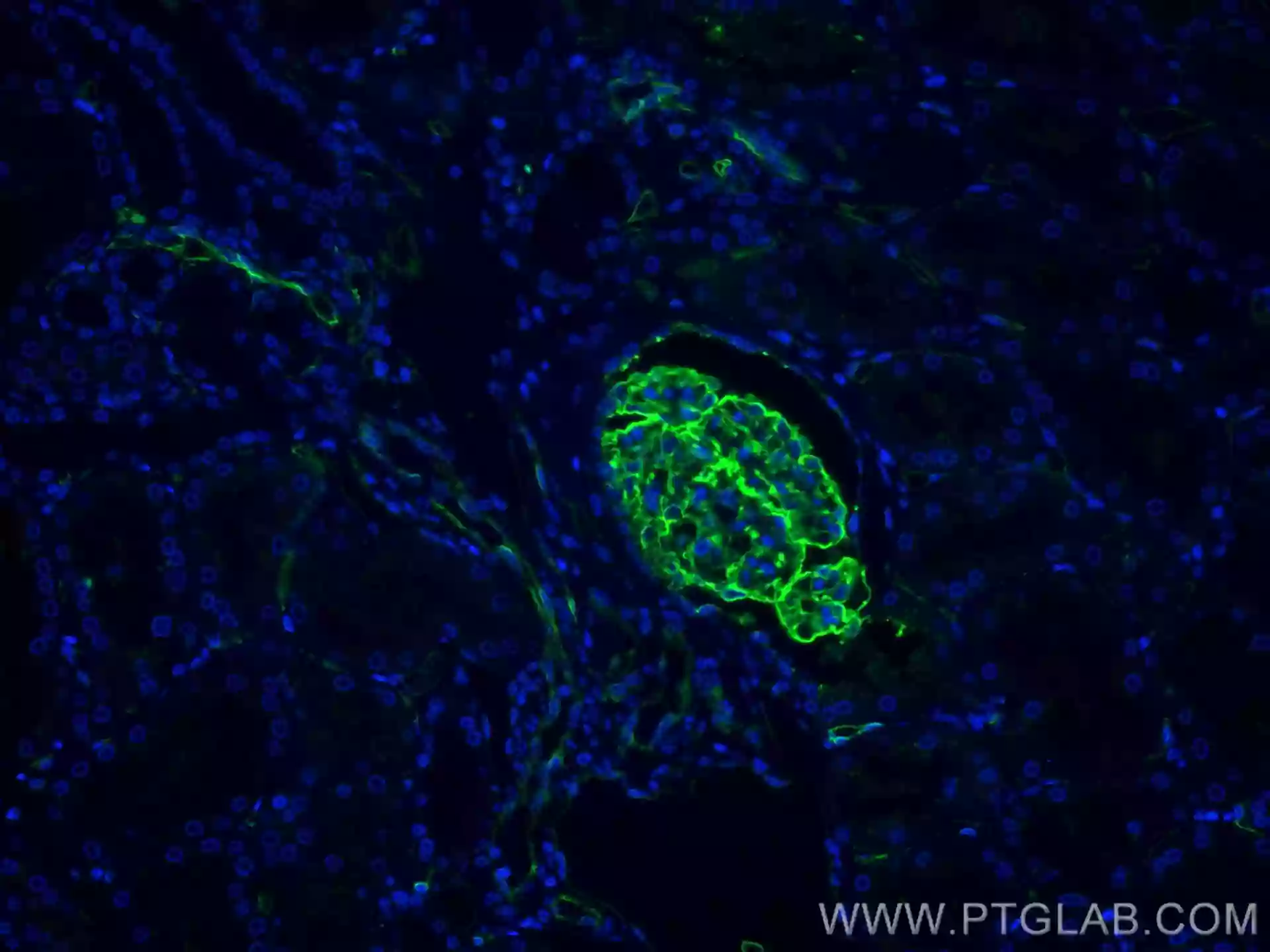 【冬バーゲン★特別送料無料！】 Podocalyxin antibody (68250-1-Ig) | Proteintech 小物